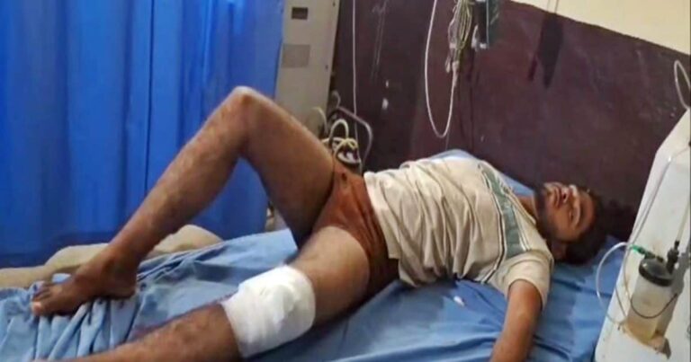 Nuh Encounter: हरियाणा के नूंह में एनकाउंटर, बदमाश के पैर में लगी गोली, अब तक 16 गिरफ्तार