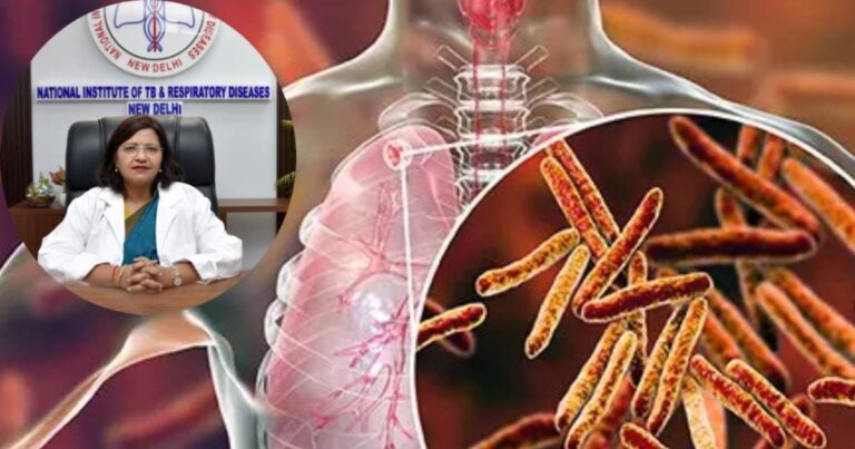 MDR TB क्या है: लक्षण, कारण, इलाज और बचाव के 5 ज़रूरी रूल्स.