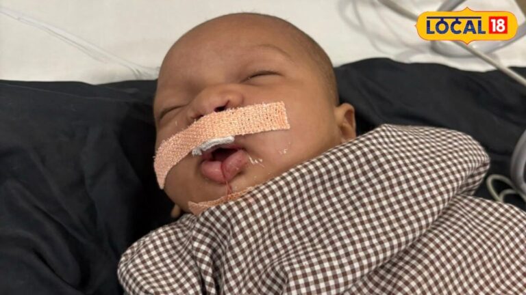RBSK के तहत बच्चों की लाखों रुपये की सर्जरी निःशुल्क, 32 स्वास्थ्य स्थितियों की होती है जांच